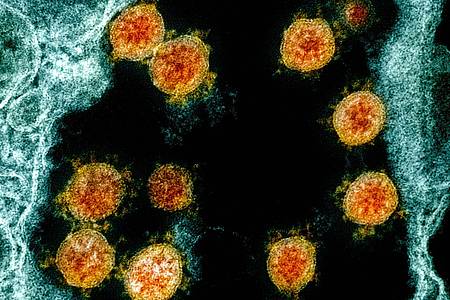 Diese vom «National Institute of Allergy and Infectious Diseases Integrated Research Facility» zur Verfügung gestellte elektronenmikroskopische Aufnahme aus dem Jahr 2020 wurde farblich bearbeitet und zeigt Partikel des Coronavirus SARS-CoV-2, (in Orange), die von einem Patienten isoliert wurden.